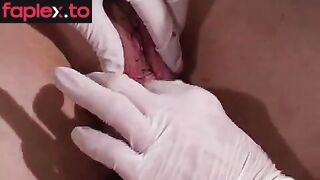 Suturing her Testicles into a Pussy – MISTRESS TRISH