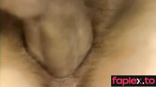  Hairy